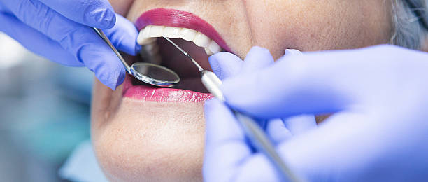 Best Chipped Tooth Repair Near Me  in Kenner, LA